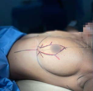 ImagenDestacada